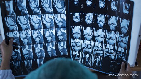 Präzision, die Vertrauen schafft – Moderne bildgebende Diagnostik